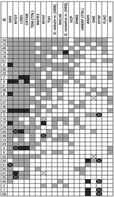 The Diagnostic Value of MRI Pattern Recognition in Distal Myopathies